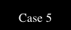  Case 5