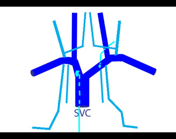 case01veins1