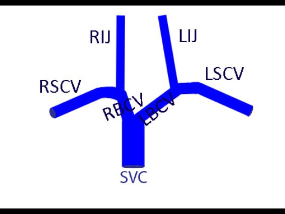 case01veins3