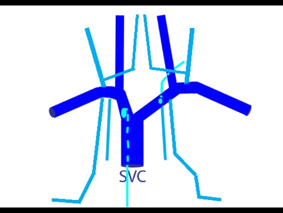 case01veins3