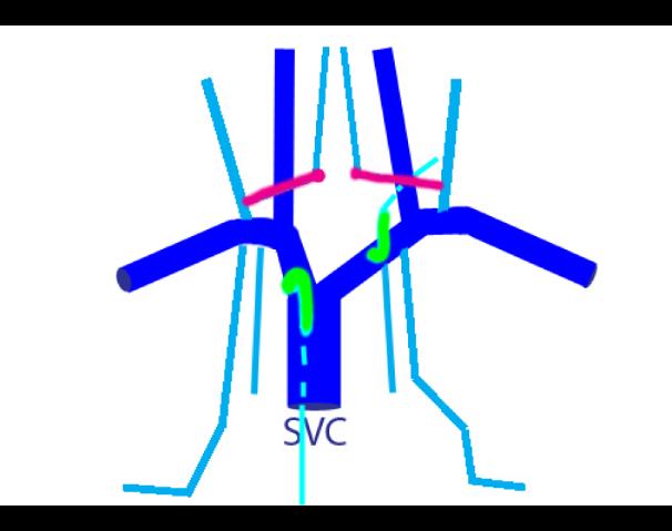 case01veins9