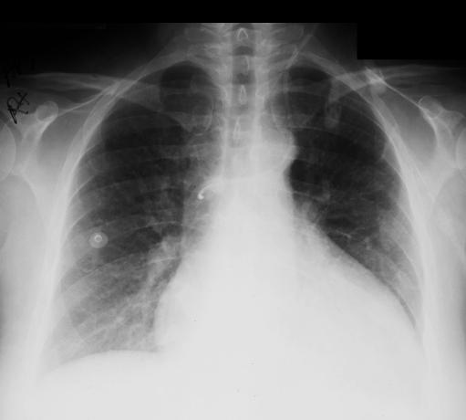 case2