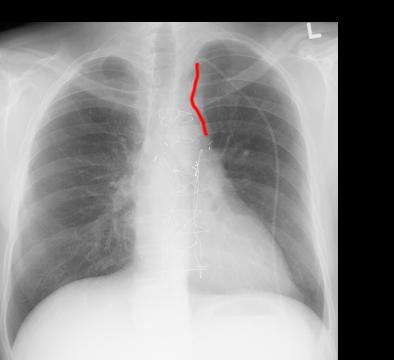 case3lab