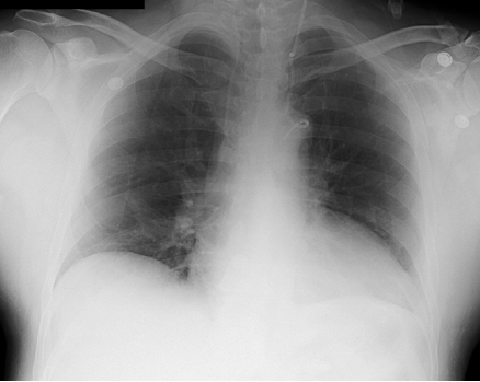 case4