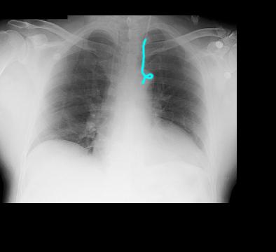 case4lab