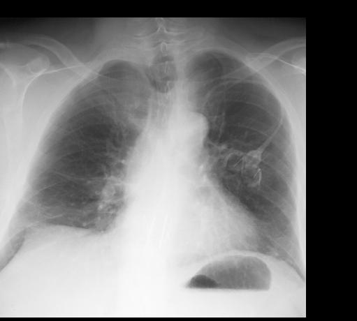 case5