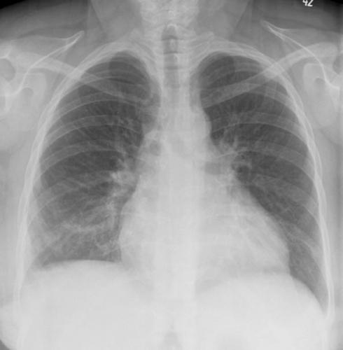 Figure10