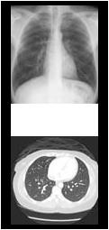 Figure1thumb