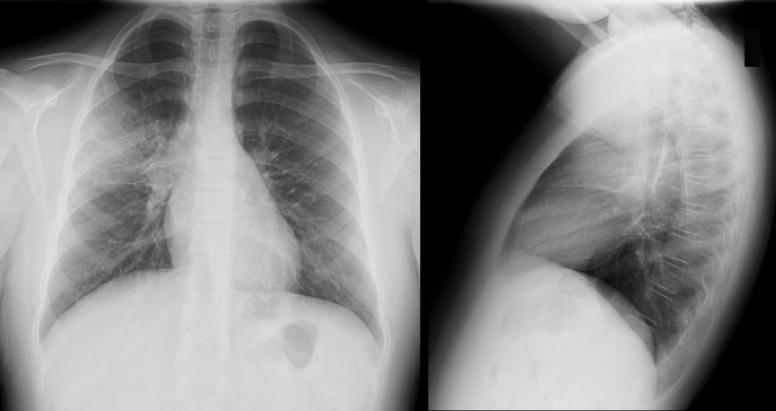Figure2