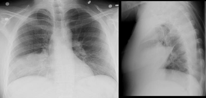 Figure3