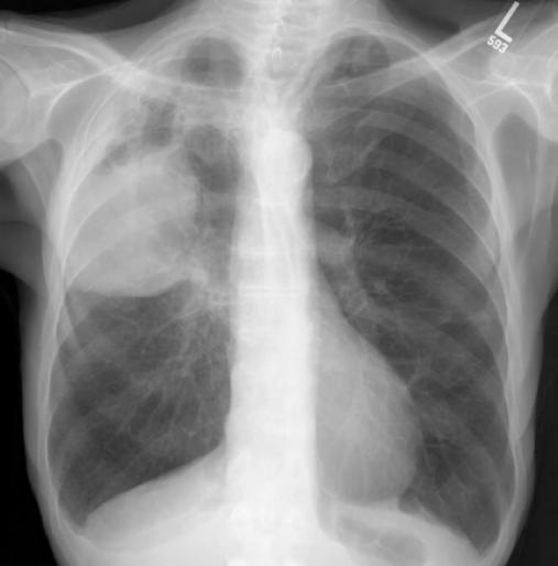 Figure4
