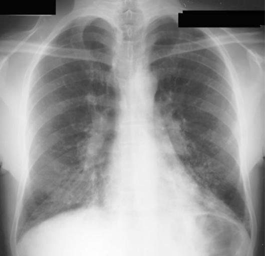 Figure5