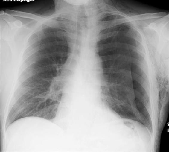 Figure7
