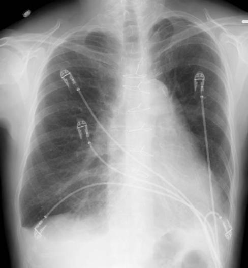 Figure8