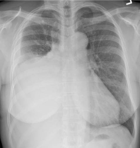 Figure9