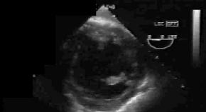 heartUS