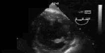 heartUS