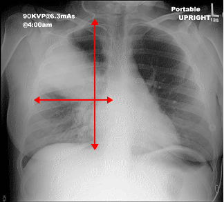 case3breath