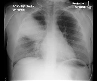 case5