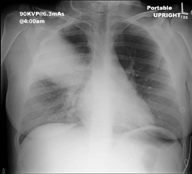 case5