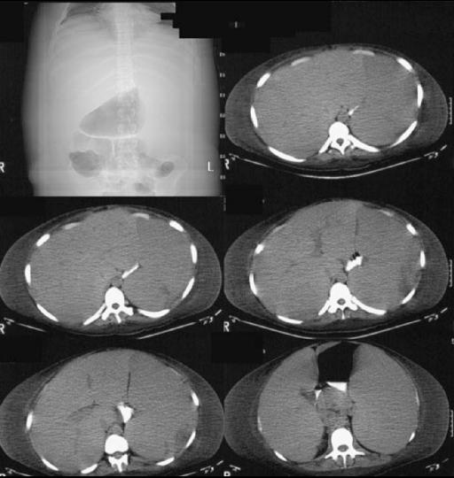 part2case3CT