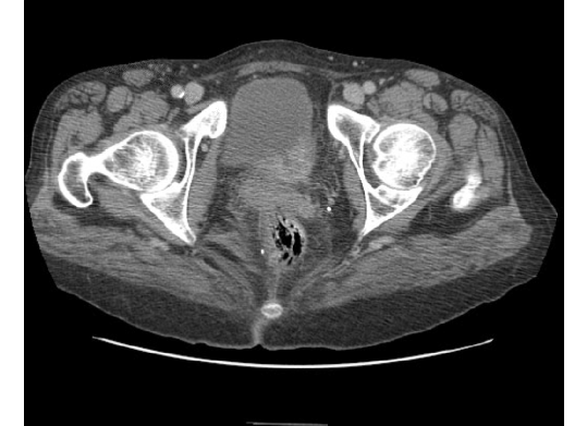 part2case4CT