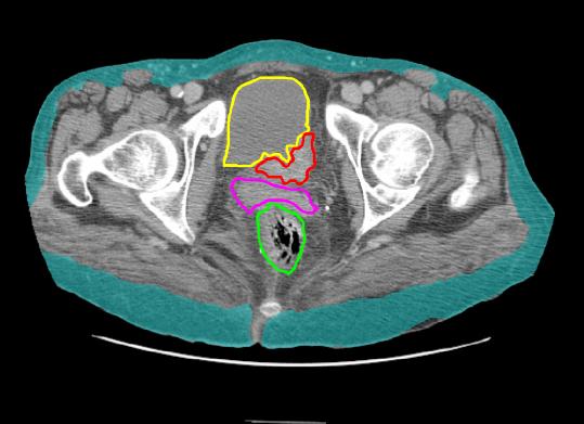 part2case4CTlab