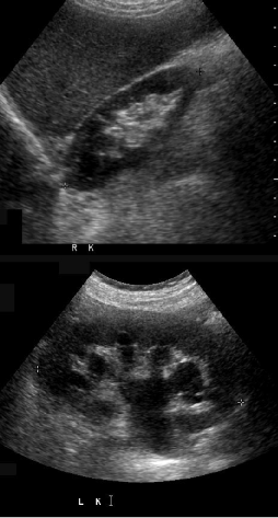part2case4im1