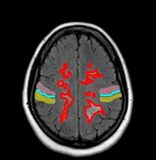 headFLAIR2lab