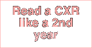 Read a CXR like a