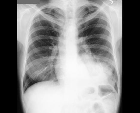 case1bkg