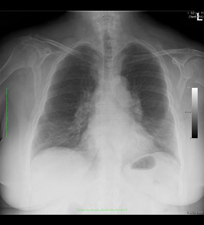 case5