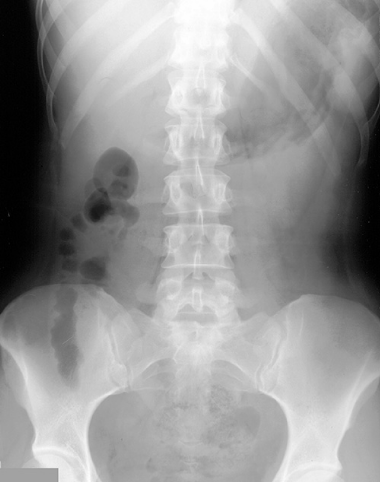 case1KUB