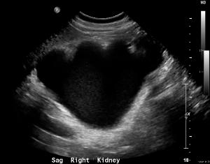 RENALULTRASOUND