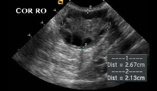 case1example4