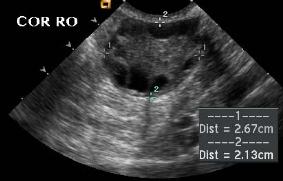 case1example4