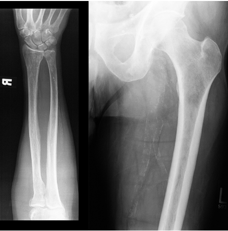 case5