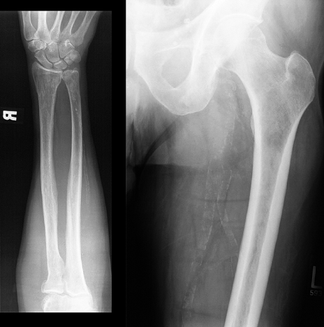 case5