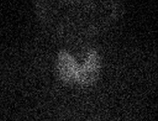 ThyroidScanLEHR