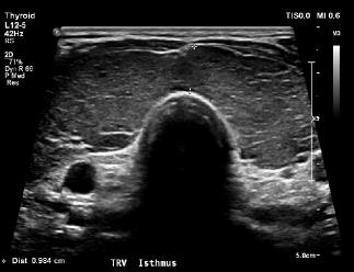 USTHYROID1104