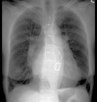 valveC1PAbkgnd