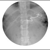 celiac08inv