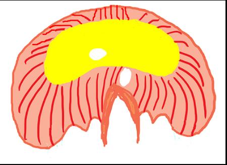 diaphragm1