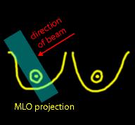 MLO