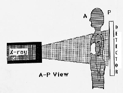 APdiagram
