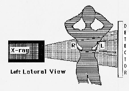 latdiagram