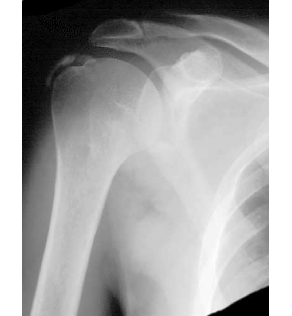 topic1image1