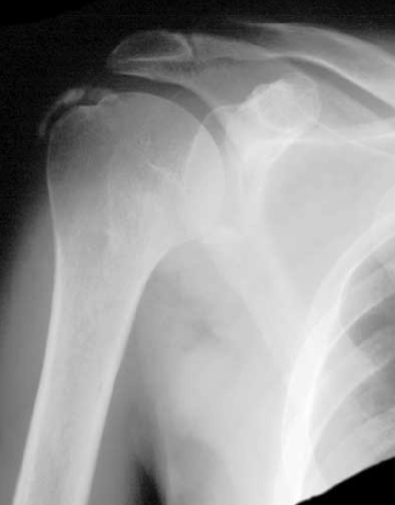 topic1image1