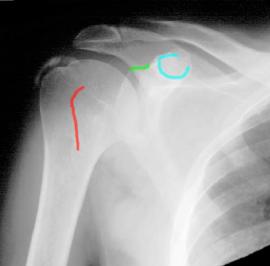 topic1image4
