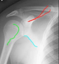 topic1image5